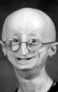   - Sam Berns